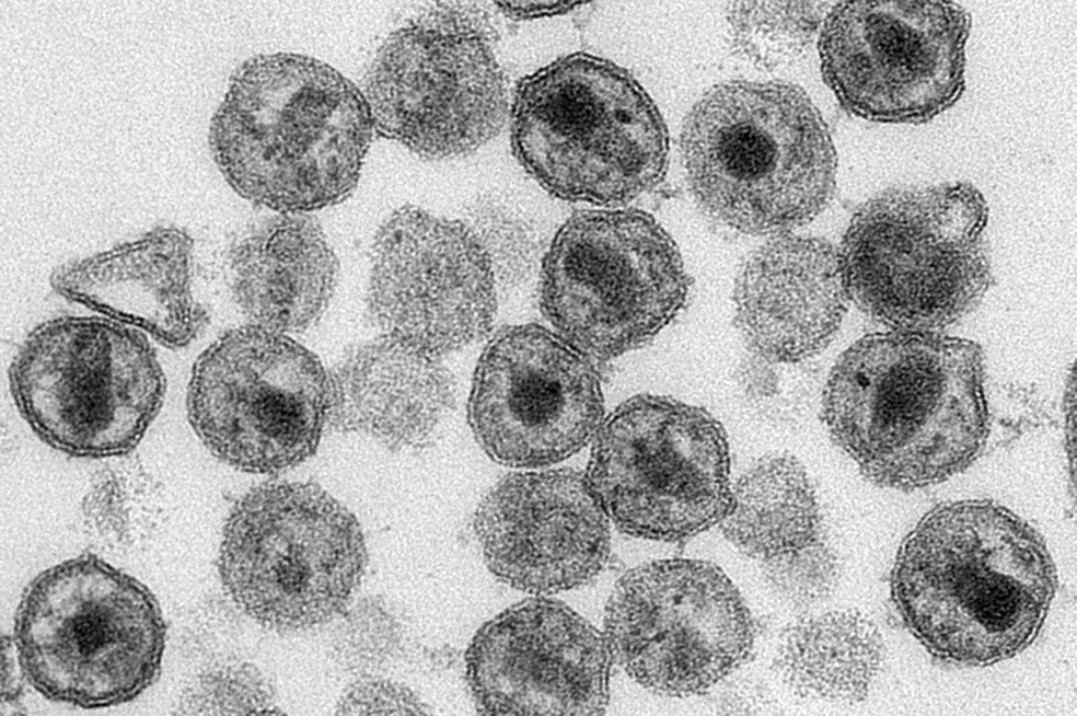 Clulas do vrus HIV viries em imagem microscpica produzida em 2011 Foto Maureen Metcalfe Tom HodgeCDCAP