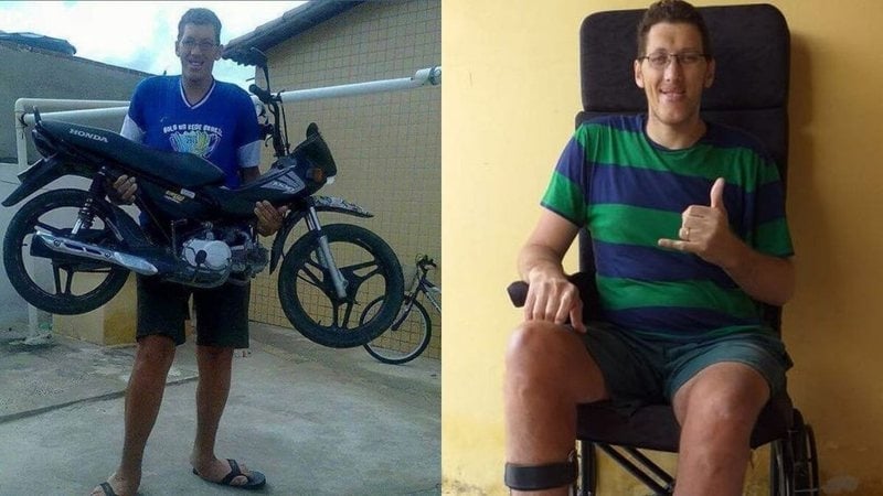 Aventuras na Histria Homem mais alto do Brasil passar por cirurgia para amputar a perna
