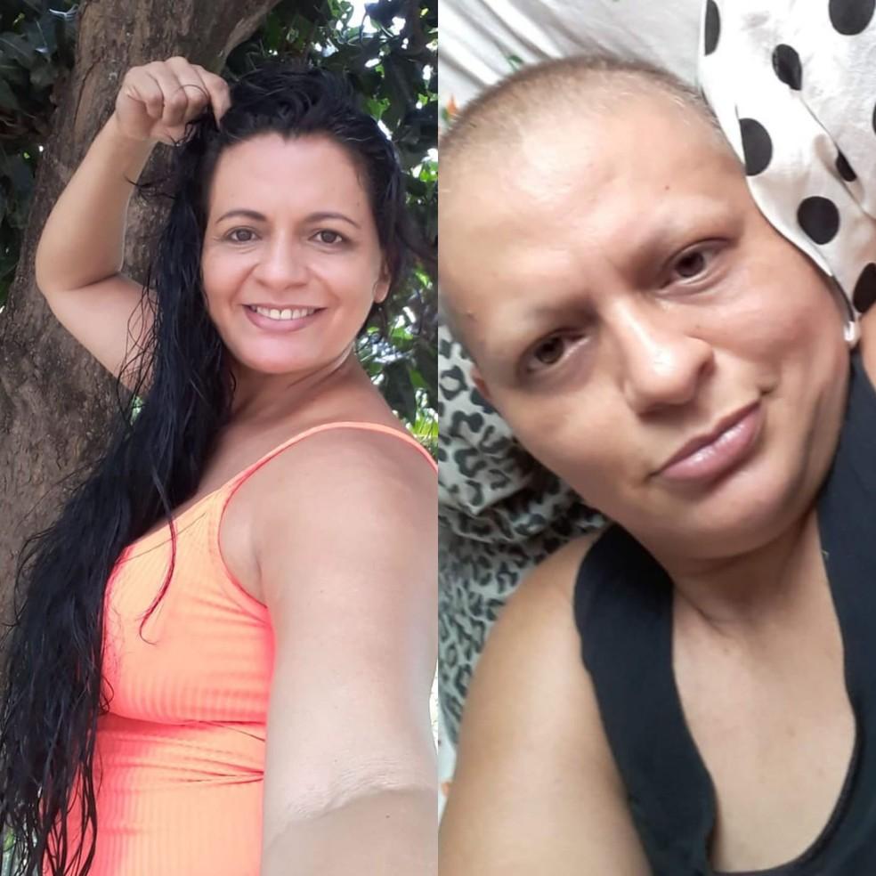 Edileny Mayre em fotos antes e durante o tratamento do cncer Foto Reproduo