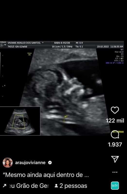 A atriz Viviane Arajo mostrou o rosto do beb em imagem de ultrassom
