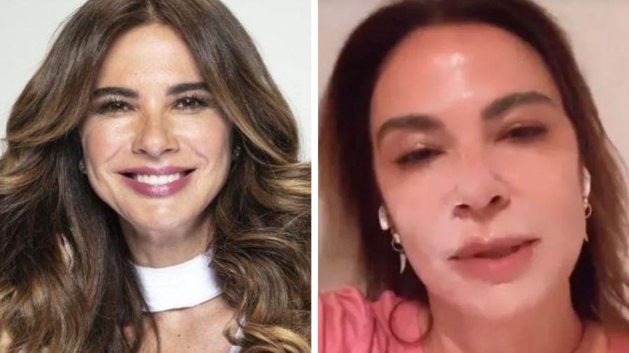 Luciana Gimenez comenta que queimou o rosto - ReproduoInstagram