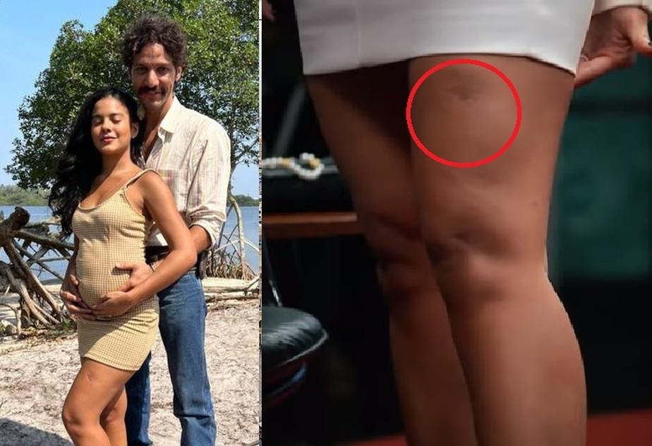 Bella Campos revela que teve a perna abocanhada por jacar no Pantanal