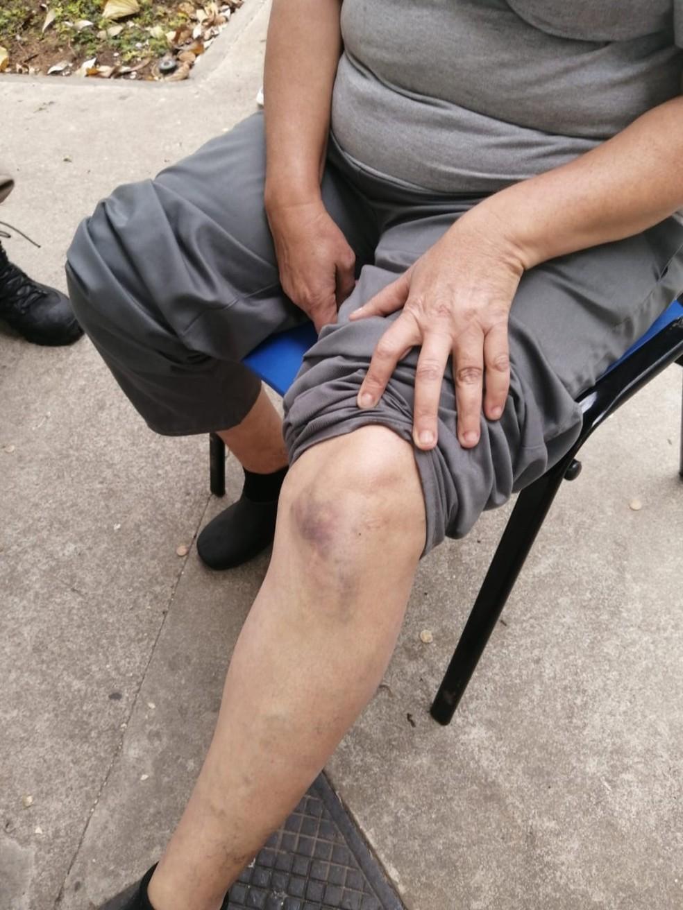 Faxineira machucou o joelho durante agresso em BH Foto Redes sociaisReproduo
